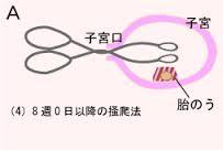 そうは手術.jpg