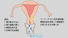 フーナーテストでわかること.jpg