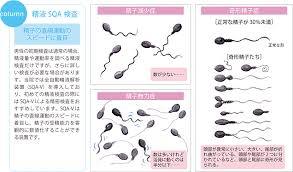 精液検査.jpg