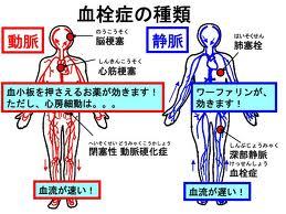 血栓症.jpg