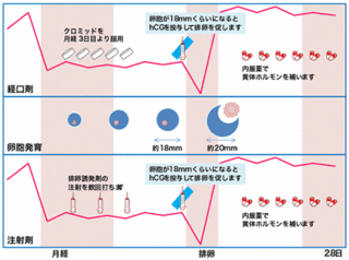 黄体機能不全投薬.gif
