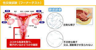 フーナーテスト1.jpg